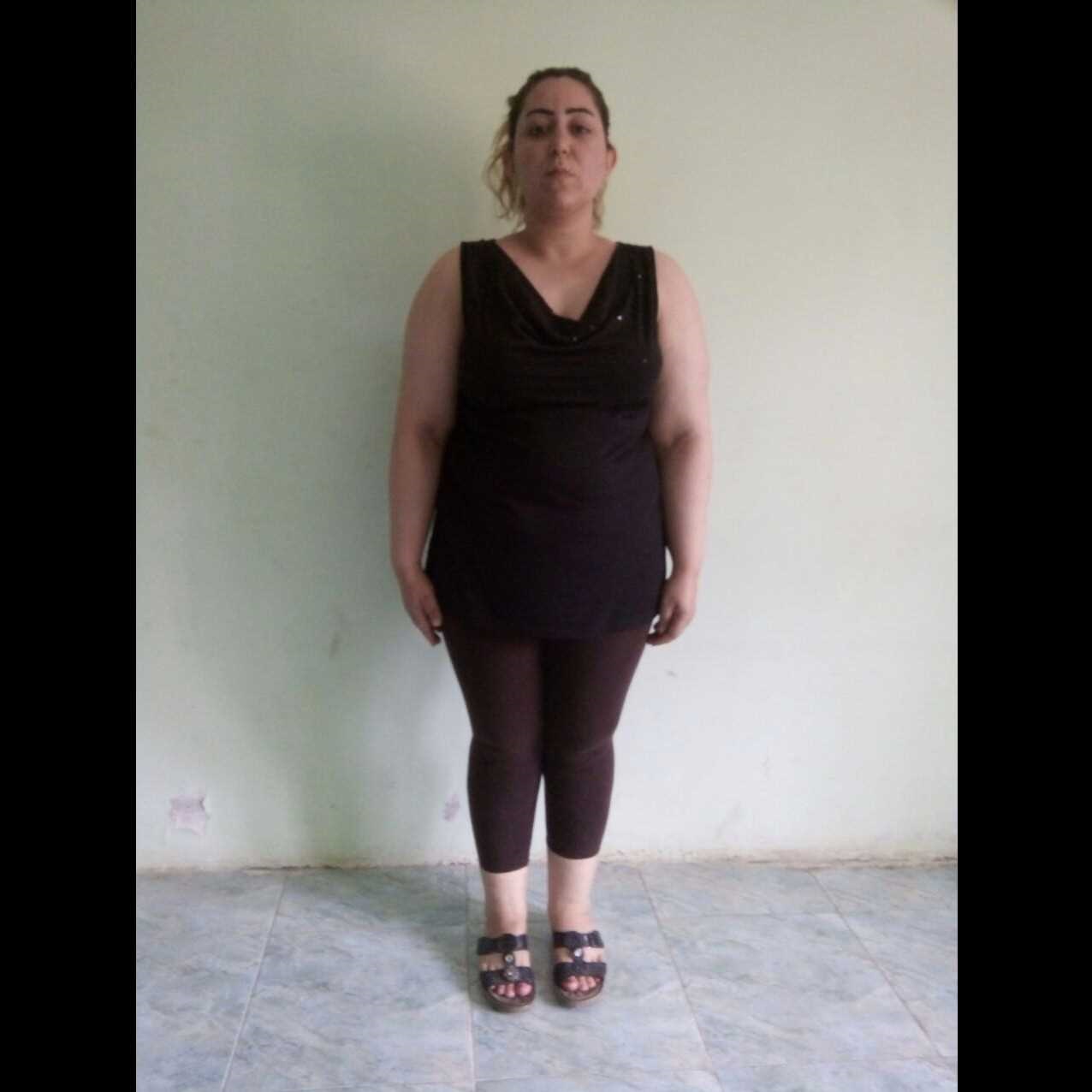 فاطمة من فلسطين و نزول 40 كيلو خلال 11 شهر بعملية تكميم المعدة